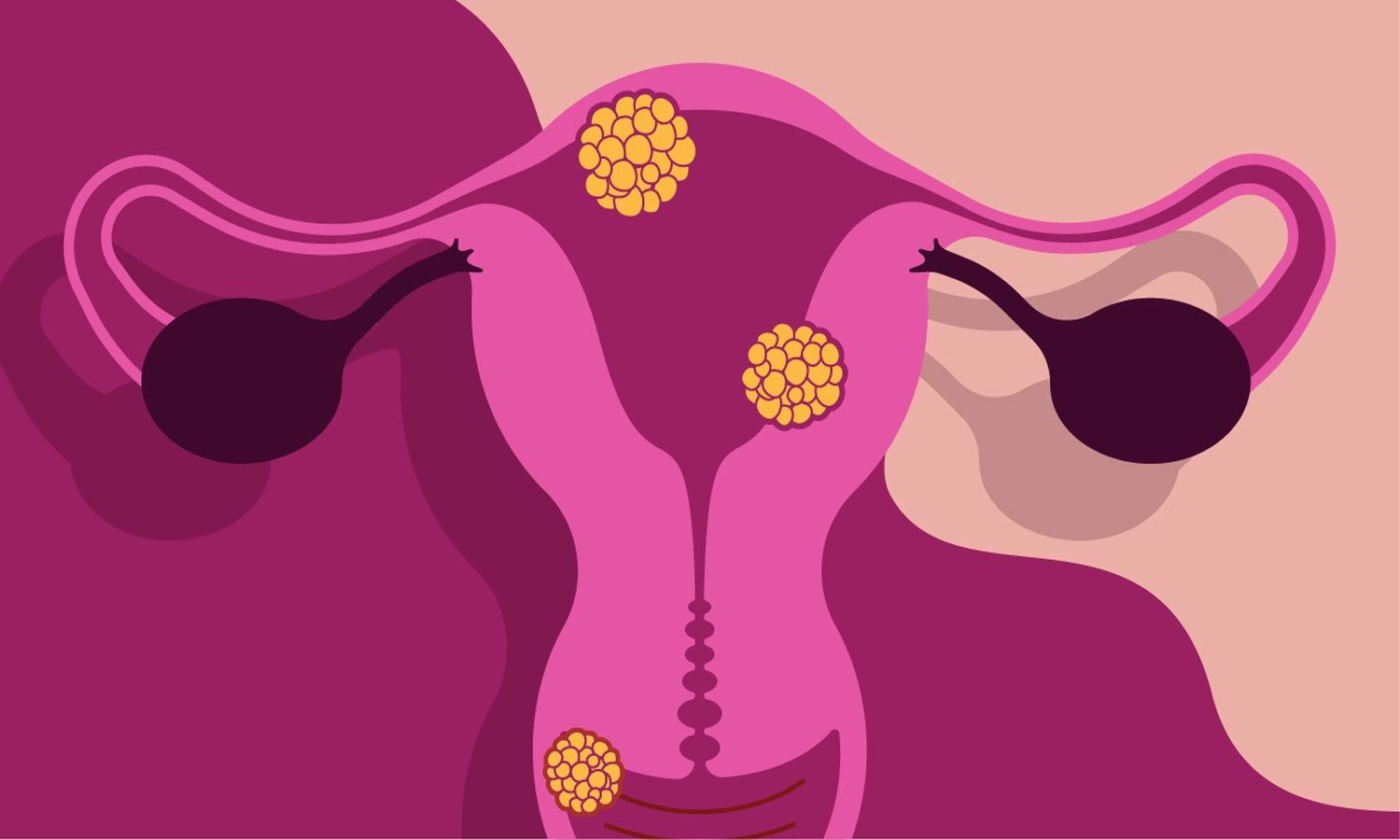GenixPRO Vaginal Health Screening